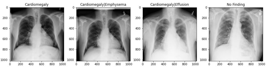 Chest x-rays